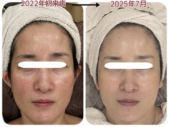 ピエルクララ(Piel clara)