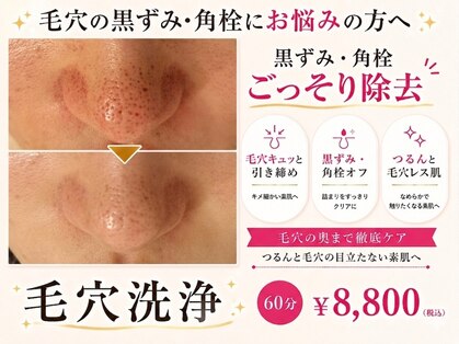 エリン(ERIN)の写真