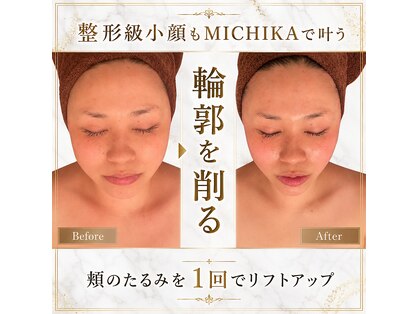 ミチカ(MICHIKA)の写真