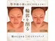 ミチカ(MICHIKA)の写真