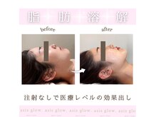 エイシスグロウ(asis glow.)の雰囲気(「医療提携サロン」だから出来る“切らない”小顔施術)
