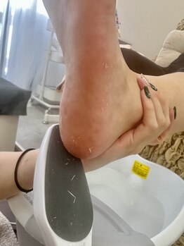 リノ(lino)の写真/カサカサ角質ケアでフットがつるつるに!極上仕上げで気分もリフレッシュ♪