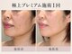 トリプルサンショップ 京都店の写真/【京都/四条】年齢とともに気になるほうれい線・たるみ・ハリ不足を丁寧に集中ケアする大人のフェイシャル