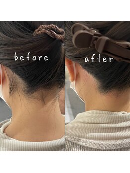 デザインファム(DESIGN FAM)/うなじワックス脱毛☆