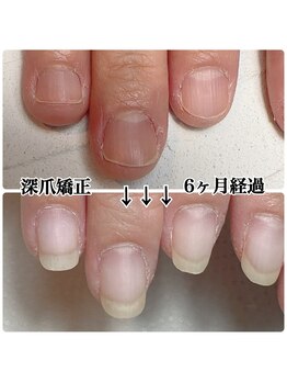 本当に伸びる！