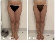 美人バスト 川崎店/【痩身・ダイエット】 川崎/脚☆