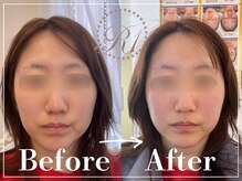 R-1ビューティーサロン 表参道/Before＆After