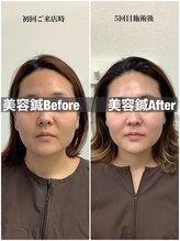ハリサロンドオフ 堺東店(hari salon de off)/お客様のbefore→after