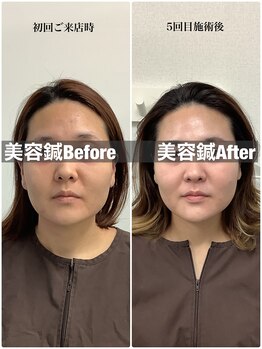 ハリサロンドオフ 堺東店(hari salon de off)/お客様のbefore→after
