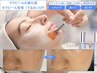 【30代以降のお肌にハリと透明感を】セラピール（ニキビケア/美白ケア）登場