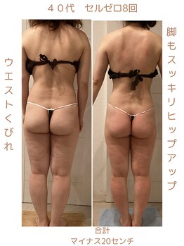 フォーユー マシバメディカル(For You Mashiba Medical)/セルゼロ８回　４０代