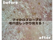 シャイニー(Shiny)の雰囲気（マイクロスコープでお肌診断/毛穴の状態が目で見えるサロン）