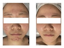 カノン(Kanon)/お肌の調子を整える