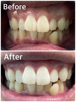 プラチナムビューティー 横須賀店/ビフォーアフター