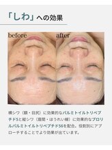 ファゴッド(FaGOD)/ラミネーションピール