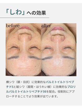 ファゴッド(FaGOD)/ラミネーションピール