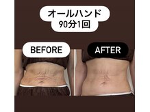 リトリート(Retreat)/愛式リンパ90分1回