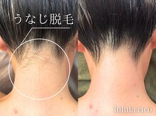 ルルラ リコ(lulula rico)/【成人式前に】うなじ脱毛
