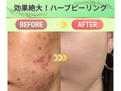 クラッシーガール ダンディエール(QlassyGirl DANDYELL)の写真