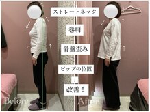 ユルル 刈谷店(Yururu)/変化(骨盤整体＆猫背整体)