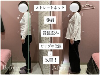 ユルル 刈谷店(Yururu)/変化(骨盤整体＆猫背整体)