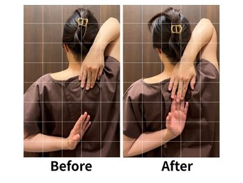 ここいろ/【Before/After】五十肩・巻き肩