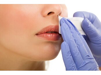 ウパラギンザ(Upala Ginza)の写真/各パーツごと脱毛可！【お好みでW脱毛の組み合わせOK】もみあげデザインワックスW脱毛なら短期で脱毛完了◎