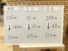 美整庵 谷山店(BISEIAN)/エラ－1.1cm の写真