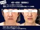 ジュジュ(juju)の写真/【当店人気!たるみ引き締め小顔リフトアップの贅沢8工程フルコース★2台の最新マシンで導く美顔造形】