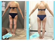 千歳の女神 岡崎店/【施術風景】Before/After