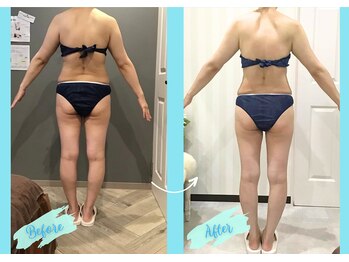 千歳の女神 岡崎店/【施術風景】Before/After