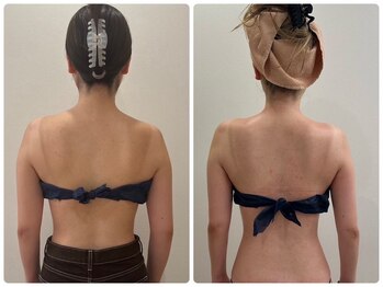 ルナグランデ 心斎橋店(Luna grande.)/結果が目に見て分かる