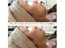 アーニャビューティー(Anya Beauty)の雰囲気（結果はもちろん、癒される施術、体感も大切にしています☆）
