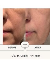 七や美肌/縦開き毛穴フェイシャル