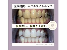 ボヌール(Bonheur)の雰囲気（医療提携ホワイトニング♪自信を持てる白い歯へ★）