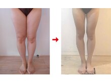 フォーレディ 恵比寿店/太もも★-12.1ｃｍ