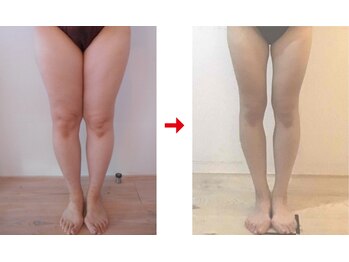 フォーレディ 恵比寿店/太もも★-12.1ｃｍ