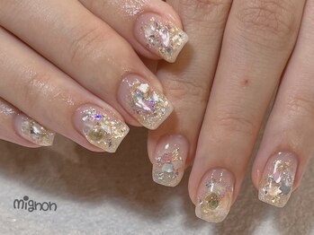 ミニョン(mignon)/mignon定額デザイン