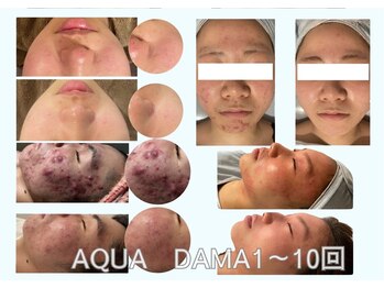 リジュベネーションサロン アリス(Alice)/アクアダーマB&A