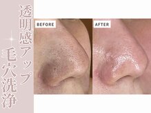 グロー(GROW)の雰囲気（【ビフォーアフター】しっかりと効果実感☆通い放題サブスクも◎）