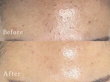 クリアー(CLEAR.)/【Before＆After】