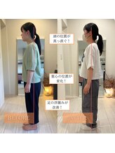 サンテリア(Santelia)/猫背と巻方、座り姿勢