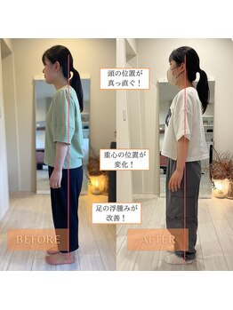 サンテリア(Santelia)/猫背と巻方、座り姿勢