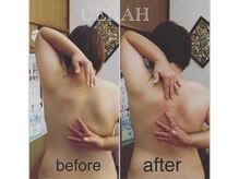 リラクゼーションルーム チュラ(Relaxation Room CERAH)/3D深部リンパ