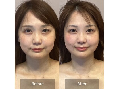 アイビー 二子玉川店(IB)の写真