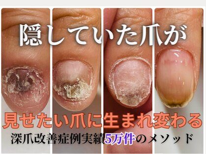 ポメロ(POMELO)の写真