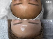 ナチュールムーン(Nature moon.)/ピーリング