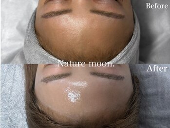 ナチュールムーン(Nature moon.)/ピーリング