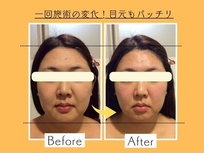 ウェルビープラーカ(Well-beプラーカ)の写真