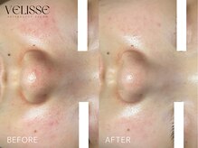 ヴェリス 福岡店(Velisse)/